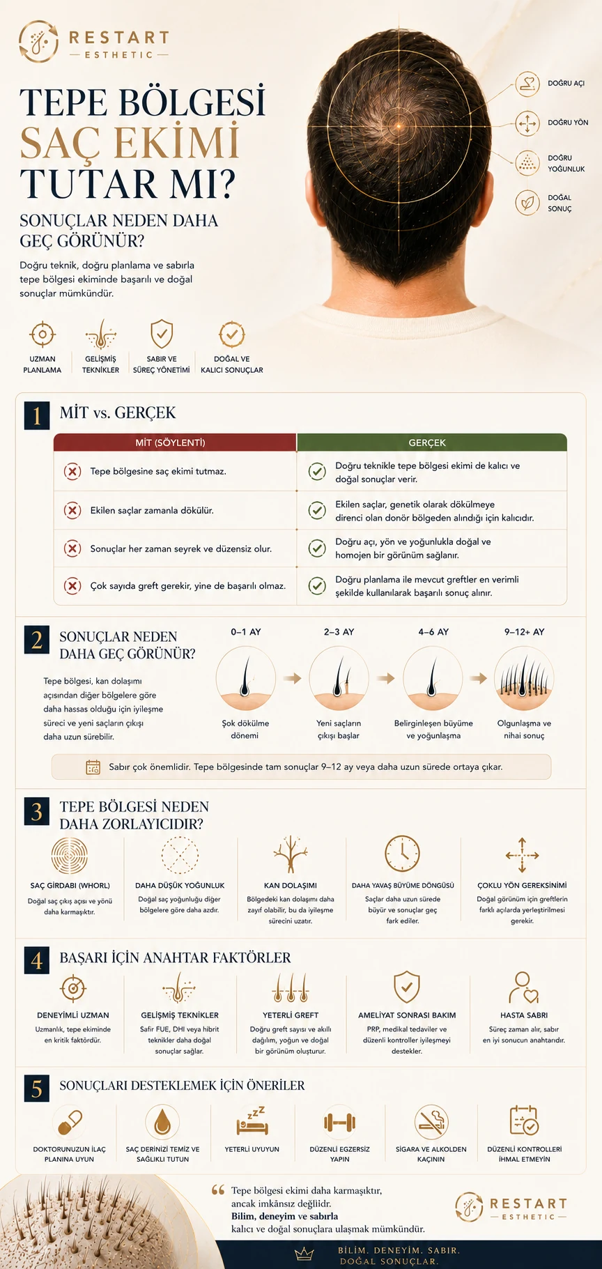 Tepe bölgesi saç ekiminde mitler, sonuç zaman çizelgesi, girdap yapısı ve başarı faktörlerini açıklayan Türkçe infografik