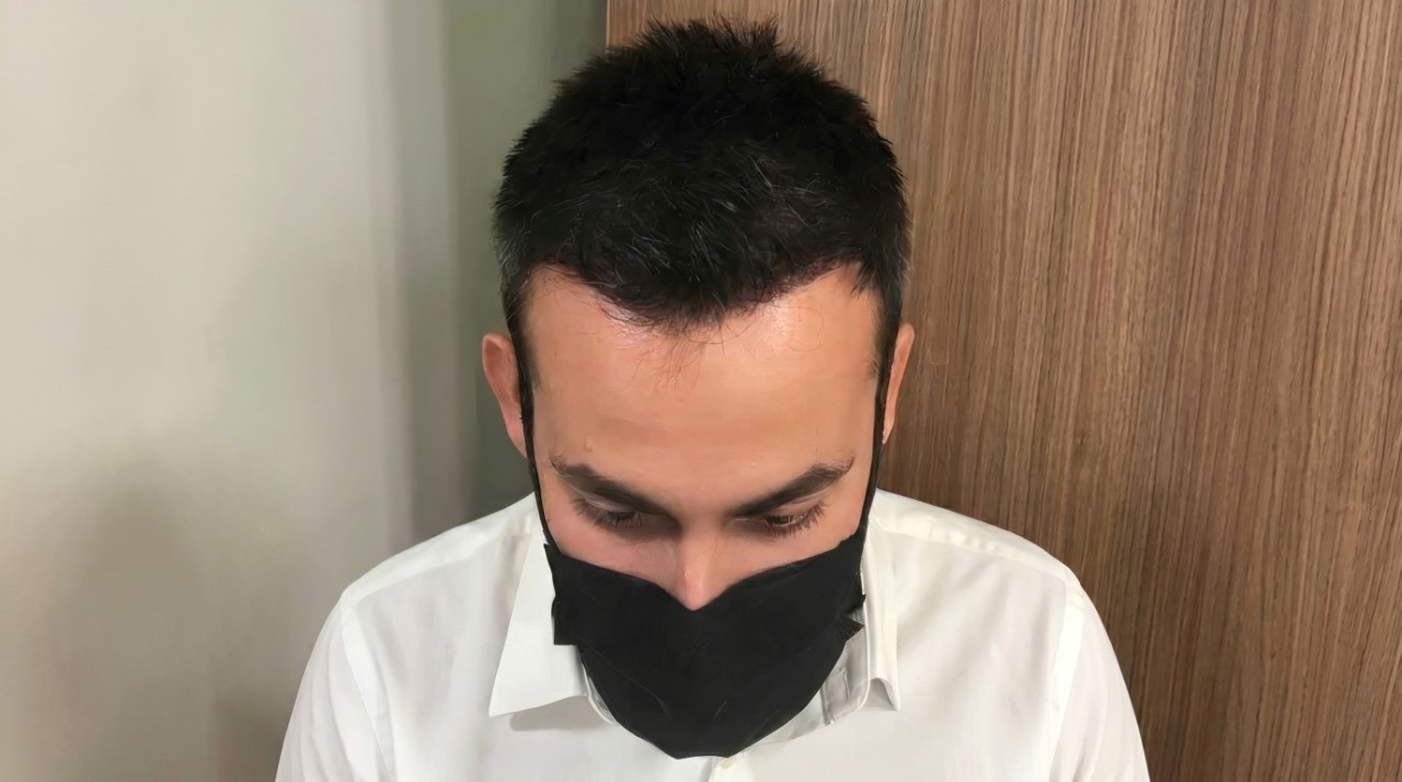 After